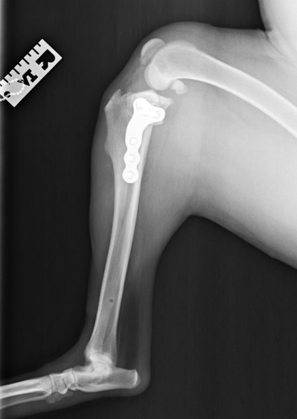 leg x-ray 